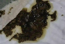 窝屎图片,揭秘动物排泄背后的生态智慧