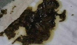 窝屎图片,揭秘动物排泄背后的生态智慧