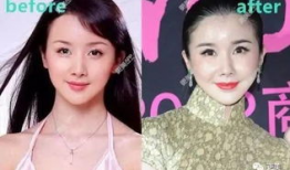 娱乐圈的假脸,揭秘明星假脸背后的秘密